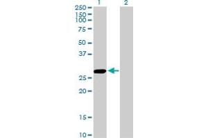 Western Blot analysis of CCBL1 expression in transfected 293T cell line by CCBL1 monoclonal antibody (M02), clone 1B12. (CCBL1 Antikörper  (AA 1-374))