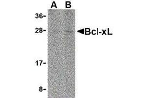 Western Blotting (WB) image for anti-BCL2-Like 1 (BCL2L1) (C-Term) antibody (ABIN2477605) (BCL2L1 Antikörper  (C-Term))
