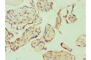 Immunohistochemistry of paraffin-embedded human placenta tissue using ABIN7172529 at dilution of 1:100 (E2F6 Antikörper  (AA 1-281))
