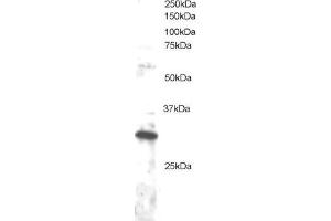 ABIN184710 staining (1µg/ml) of Jurkat lysate (RIPA buffer, 30µg total protein per lane). (DKK4 Antikörper  (C-Term))