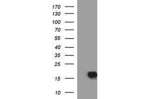 Image no. 1 for anti-SIVA1, Apoptosis-Inducing Factor (SIVA1) antibody (ABIN1500941) (SIVA1 Antikörper)