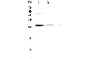 Western blot analysis of Oncostatin M using anti-Oncostatin M antibody . (Oncostatin M Antikörper  (AA 25-206))