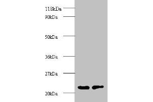 Western blot All lanes: proteasome subunit beta type-2 antibody at 2 μg/mL Lane 1: EC109 whole cell lysate Lane 2: 293T whole cell lysate Secondary Goat polyclonal to rabbit IgG at 1/15000 dilution Predicted band size: 23 kDa Observed band size: 23 kDa (PSMB2 Antikörper  (AA 1-201))