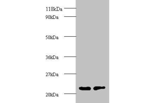 PSMB2 Antikörper  (AA 1-201)