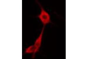 ABIN6274669 staining HuvEc cells by IF/ICC. (GBP1 Antikörper  (C-Term))