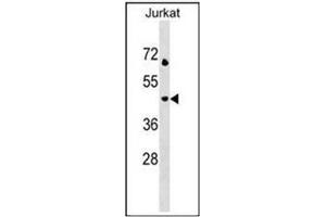 Western blot analysis using CD208 / LAMP3 Antibody (N-term) in Jurkat cell line lysates (35ug/lane).