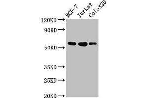 Western Blot Positive WB detected in: MCF-7 whole cell lysate, Jurkat whole cell lysate, Colo320 whole cell lysate All lanes: IRX4 antibody at 3 μg/mL Secondary Goat polyclonal to rabbit IgG at 1/50000 dilution Predicted band size: 55, 58 kDa Observed band size: 55 kDa (IRX4 Antikörper  (AA 287-363))