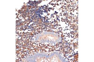 Immunohistochemistry of paraffin-embedded human appendix using EHD1 Rabbit mAb (ABIN7266911) at dilution of 1:100 (40x lens). (EHD1 Antikörper)