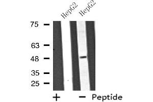 Western blot analysis of extracts from HepG2 cells using ATP6V1C2 antibody. (ATP6V1C2 Antikörper  (Internal Region))
