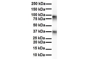WB Suggested Anti-CPEB4 antibody Titration: 1 ug/mL Sample Type: Human Raji (CPEB4 Antikörper  (N-Term))