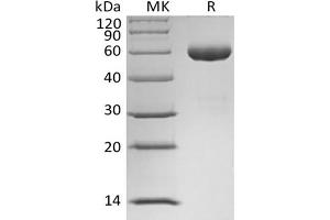 Western Blotting (WB) image for Angiopoietin 1 (ANGPT1) protein (Fc Tag) (ABIN7319856) (Angiopoietin 1 Protein (ANGPT1) (Fc Tag))