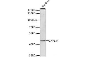 Western blot analysis of extracts of Rat liver using ZNF134 Polyclonal Antibody at dilution of 1:1000. (ZNF134 Antikörper)