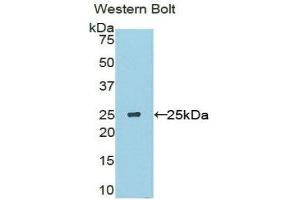 Western Blotting (WB) image for anti-Sclerostin Domain Containing 1 (SOSTDC1) (AA 24-206) antibody (ABIN1860599) (SOSTDC1 Antikörper  (AA 24-206))
