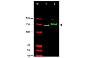 Image no. 1 for anti-GLI Family Zinc Finger 2 (GLI2) (AA 40-60), (AA 46-60), (Isoform alpha) antibody (ABIN401285) (GLI2 Antikörper  (Isoform alpha))