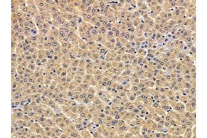 ABIN7094083 and ABIN7098127 at 1/100 staining rat liver tissue by IHC-P.