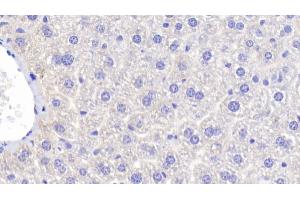 Immunohistochemistry (IHC) image for anti-Fucosidase, alpha-L- 1, Tissue (FUCA1) (AA 185-447) antibody (ABIN7439933)