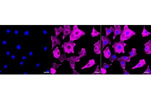 Immunocytochemical staining of C2C12 cells with Actin antibody (ABIN7797458), 1:1,000).