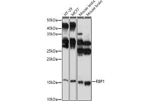 Western blot analysis of extracts of various cell lines, using RBP1 antibody (ABIN6129597, ABIN6146795, ABIN6146796 and ABIN6214136) at 1:1000 dilution. (RBP1 Antikörper  (AA 63-197))