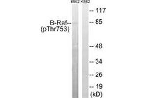 Western blot analysis of extracts from K562 cells treated with EGF 200ng/ml 30', using B-Raf (Phospho-Thr753) Antibody. (SNRPE Antikörper  (pSer753))