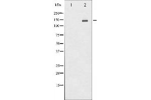 Western blot analysis of HER2 phosphorylation expression in HepG2 whole cell lysates,The lane on the left is treated with the antigen-specific peptide. (ErbB2/Her2 Antikörper  (pTyr1112))