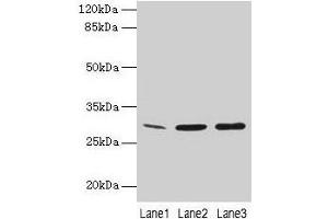 Western Blot All lanes: GTF2F2 antibody at 16 μg/mL Lane 1: Mouse spleen tissue Lane 2: K562 whole cell lysate Lane 3: A549 whole cell lysate Secondary Goat polyclonal to rabbit IgG at 1/10000 dilution Predicted band size: 29 kDa Observed band size: 29 kDa (GTF2F2 Antikörper  (AA 2-249))