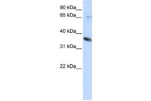 Western Blotting (WB) image for anti-ST6 (Alpha-N-Acetyl-Neuraminyl-2,3-beta-Galactosyl-1,3)-N-Acetylgalactosaminide alpha-2,6-Sialyltransferase 1 (ST6GALNAC1) antibody (ABIN2459116) (ST6GALNAC1 Antikörper)