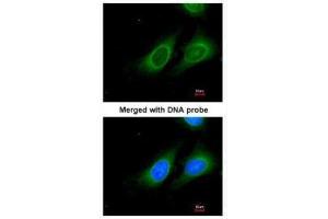 ICC/IF Image Immunofluorescence analysis of paraformaldehyde-fixed HeLa, using 15-PGDH, antibody at 1:200 dilution. (HPGD Antikörper  (C-Term))