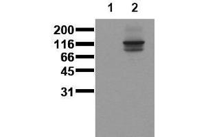 Western Blotting (WB) image for anti-M-Cadherin (CDH15) (Extracellular Domain) antibody (ABIN126735)