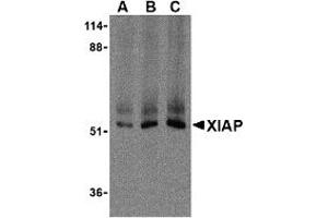 Western Blotting (WB) image for anti-X-Linked Inhibitor of Apoptosis (XIAP) (C-Term) antibody (ABIN1030806) (XIAP Antikörper  (C-Term))