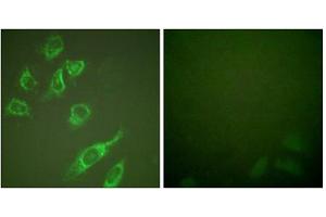 Immunofluorescence analysis of HeLa cells, treated with PMA (125ng/ml, 30mins), using 14-3-3 zeta (phospho-Ser58) antibody. (14-3-3 zeta Antikörper  (pSer58))