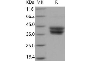 Bone Marrow Stromal Cell Antigen 1 (BST1) protein (His tag)
