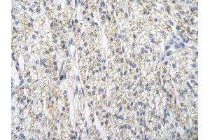 Immunohistochemistry (IHC) image for anti-Protein Arginine Methyltransferase 2 (PRMT2) (N-Term) antibody (ABIN2778663)