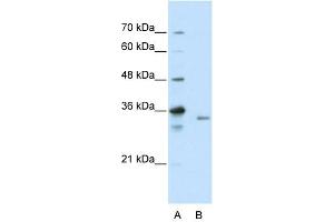WB Suggested Anti-EXOSC3 Antibody Titration:  2. (EXOSC3 Antikörper  (C-Term))