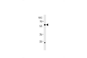 DANRE ccdc149b Antibody (N-term) Azb10009a western blot analysis in zebra fish heart tissue lysates (35 μg/lane). (CCDC149 Antikörper  (N-Term))