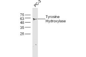 Human PC-3 lysates probed with Tyrosine Hydroxylase Polyclonal Antibody, unconjugated  at 1:300 overnight at 4°C followed by a conjugated secondary antibody at 1:10000 for 60 minutes at 37°C. (Tyrosine Hydroxylase Antikörper  (AA 101-165))