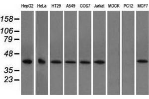 Western blot analysis of extracts (35 µg) from 9 different cell lines by using anti-ACAT2 monoclonal antibody. (ACAT2 Antikörper)