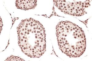 Immunohistochemistry (IHC) image for anti-DEAD (Asp-Glu-Ala-Asp) Box Polypeptide 17 (DDX17) antibody (ABIN7266688)