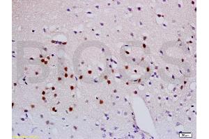Formalin-fixed and paraffin embedded mouse brain labeled with Anti-Sema3A Polyclonal Antibody, Unconjugated (ABIN737961) at 1:200 followed by conjugation to the secondary antibody and DAB staining.