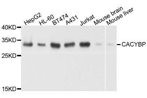 Western blot analysis of extracts of various cell lines, using CACYBP antibody. (CACYBP Antikörper  (AA 1-228))