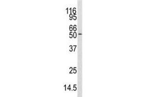 Western blot analysis of CAMKK antibody and mouse cerebellum tissue lysate. (CAMKK1 Antikörper  (AA 86-121))