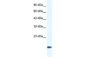 WB Suggested Anti-CSRP3 Antibody Titration:  0. (CSRP3 Antikörper  (Middle Region))