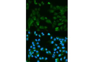 Immunofluorescence analysis of HeLa cell using PHPT1 antibody. (PHPT1 Antikörper  (AA 1-125))