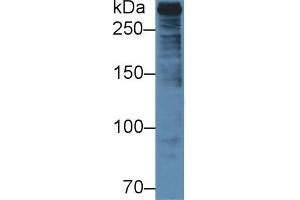 Detection of PLEC in Human U2OS cell lysate using Polyclonal Antibody to Plectin (PLEC) (PLEC Antikörper  (AA 175-400))