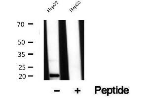 Western blot analysis of extracts of HepG2 cells, using TIM22 antibody. (TIMM22 Antikörper  (Internal Region))