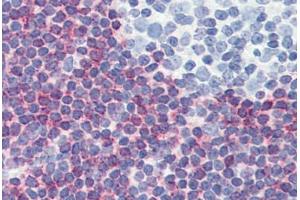 Human Tonsil (formalin-fixed, paraffin-embedded) stained with PDCD4 antibody ABIN364343 at 5 ug/ml followed by biotinylated anti-mouse IgG secondary antibody ABIN481714, alkaline phosphatase-streptavidin and chromogen. (PDCD4 Antikörper  (AA 1-469))