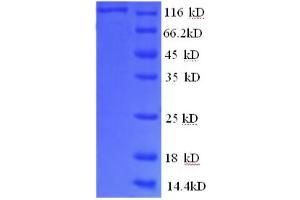 SDS-PAGE (SDS) image for phosphorylase, Glycogen, Brain (GPBB) (AA 6-843), (partial) protein (GST tag) (ABIN1047093)