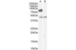 Western Blotting (WB) image for anti-Chromosome 19 Open Reading Frame 55 (C19orf55) (N-Term) antibody (ABIN2784664) (C19orf55 Antikörper  (N-Term))