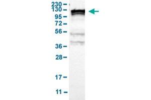 Western Blot analysis of human cell line RT-4 with KIF11 polyclonal antibody . (KIF11 Antikörper  (AA 373-477))