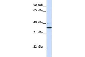 Western Blotting (WB) image for anti-UDP-Gal:betaGlcNAc beta 1,3-Galactosyltransferase, Polypeptide 1 (B3GALT1) antibody (ABIN2459310)