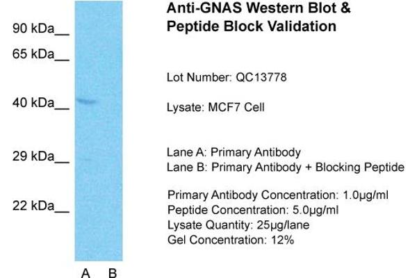 GNAS Antikörper  (N-Term)